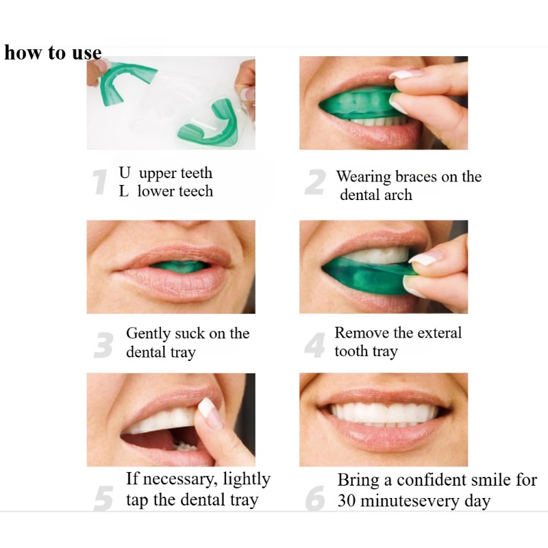 Set Vassoio per sbiancamento d - Teeth Whitening Quick recensione e prezzo