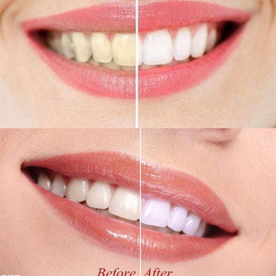 Denti di carbone di bambù dent - Teeth Whitening Ingredients recensione e prezzo
