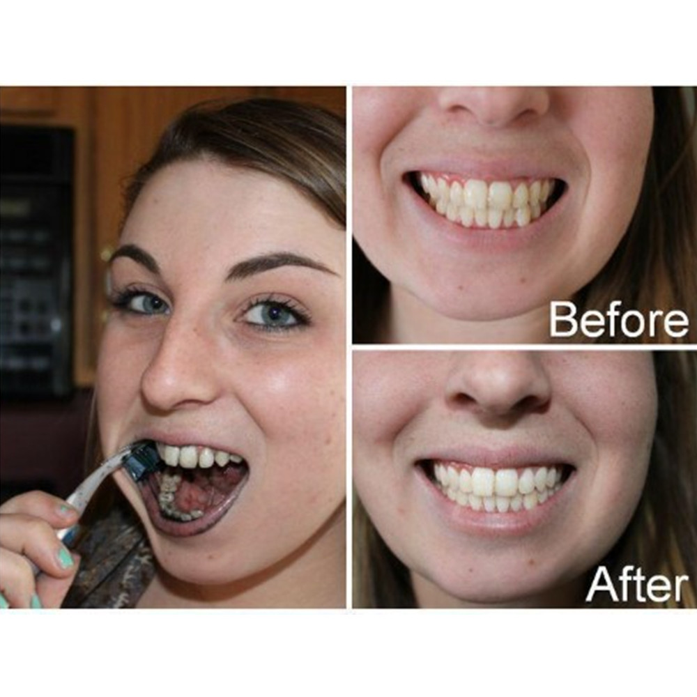 Denti di carbone di bambù dent - Teeth Whitening Ingredients recensione e prezzo