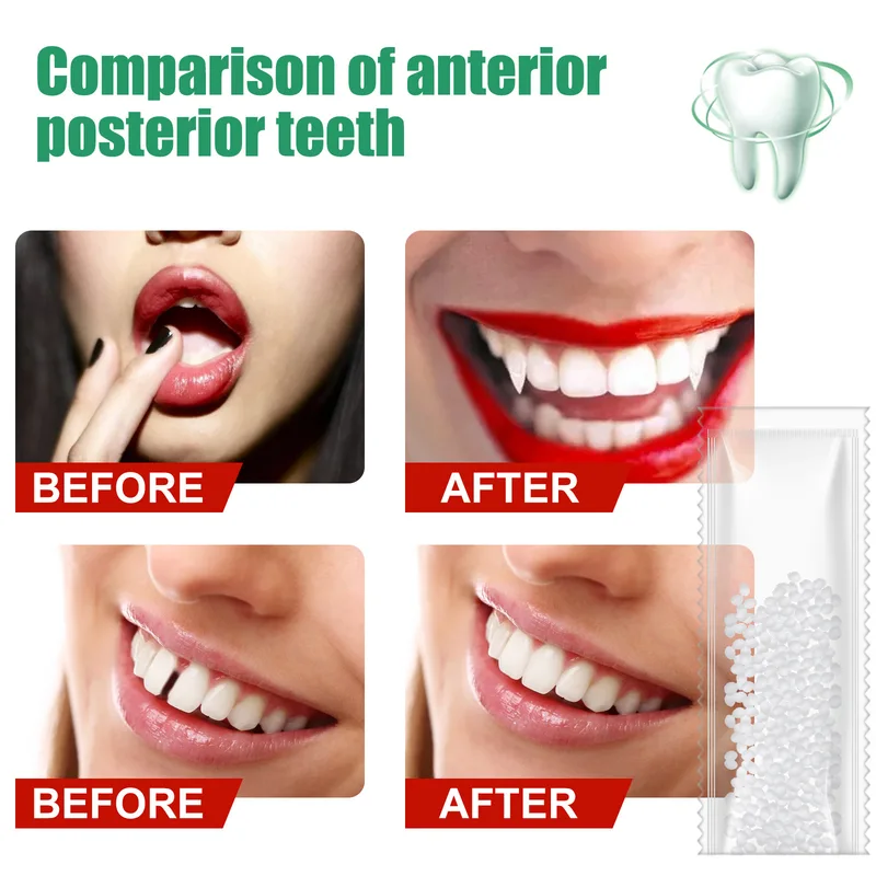 10g50g/30ml Colla per riparazi - Teeth Whitening At Home recensione e prezzo