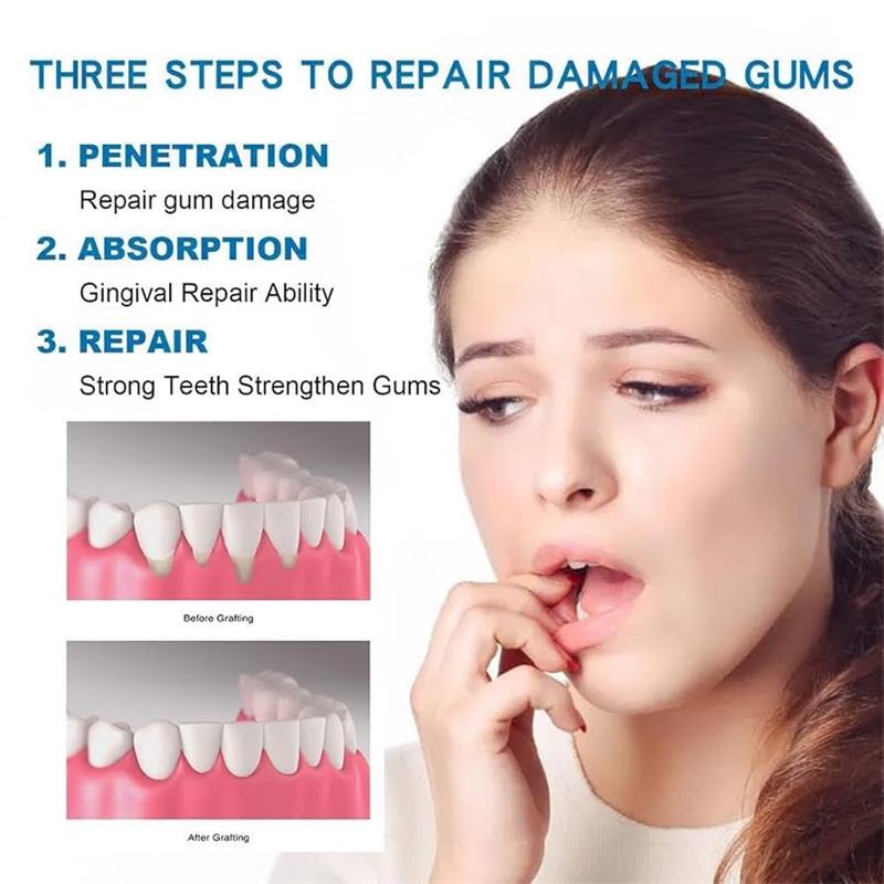 Siero Riparatore per Gengive,  - Teeth Whitening Gingival Barrier recensione e prezzo