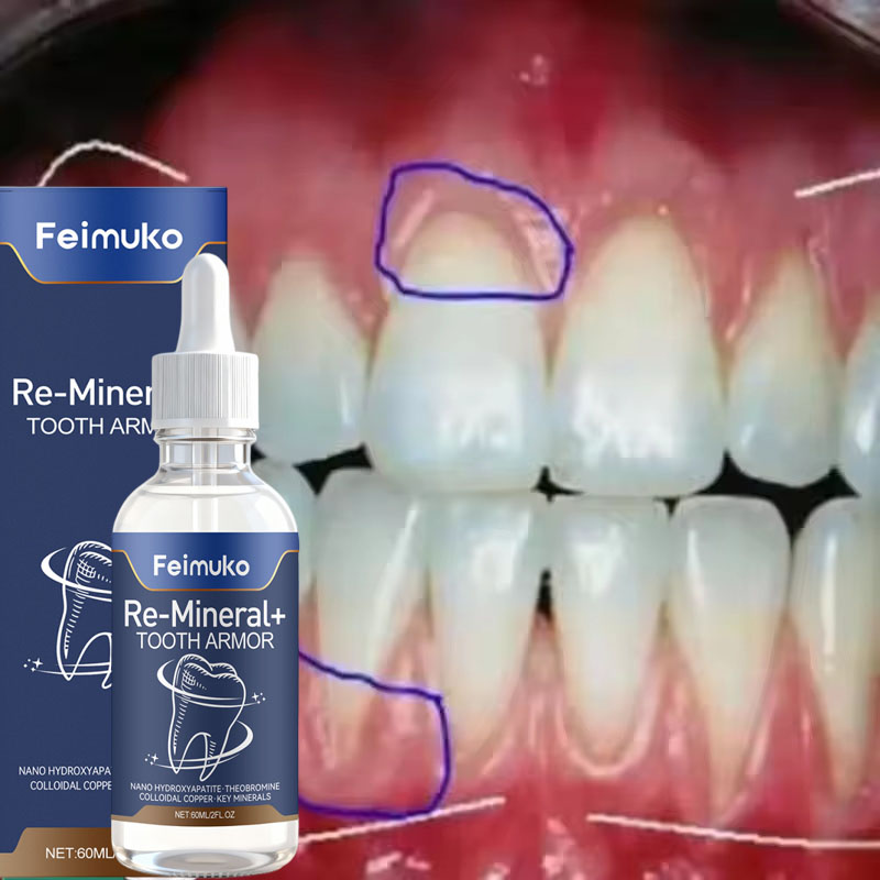 Siero Riparatore per Gengive,  - Teeth Whitening Gingival Barrier recensione e prezzo