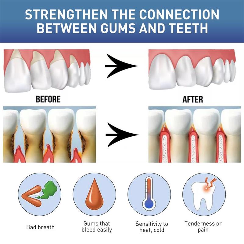Siero Riparatore per Gengive,  - Teeth Whitening Gingival Barrier recensione e prezzo