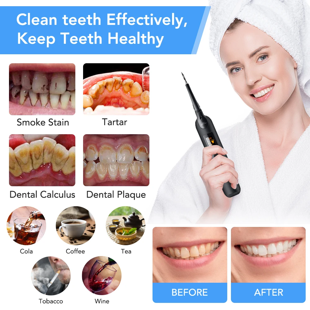 Elettrico Dentale Scaler Spazz - Teeth Whitening Toothbrush recensione e prezzo