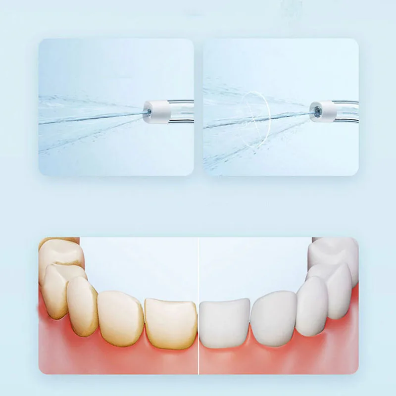 Irrigatore Orale Portatile Xia - Teeth Whitening Quick recensione e prezzo