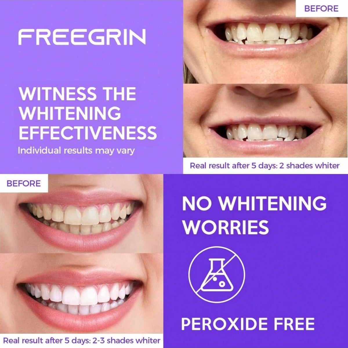 Adesivi sbiancanti per denti d - Teeth Whitening Paste recensione e prezzo
