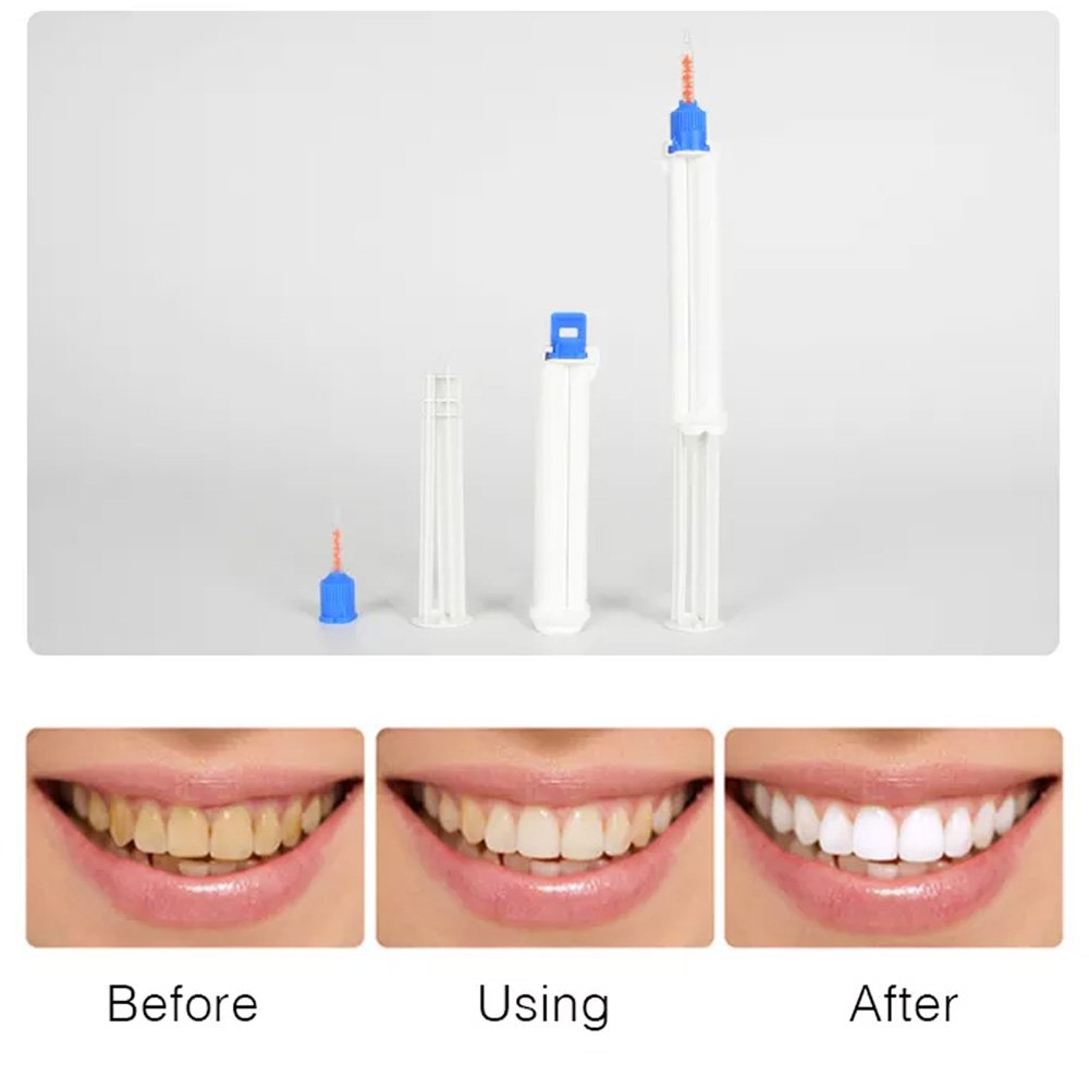 10/5/2pcs Dentale Doppio Baril - Teeth Whitening Gingival Barrier recensione e prezzo
